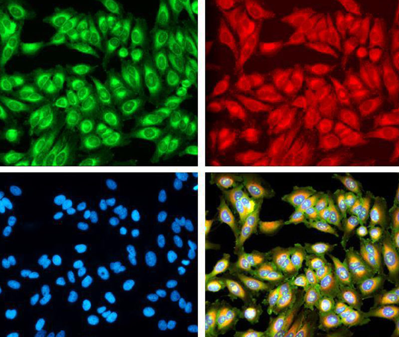 Ksilink, joining academic-industry cell imaging consortium to speed patient-based drug discovery and development