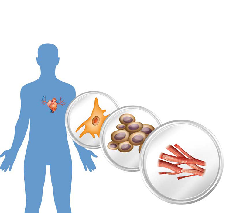 Cardiovascular disease