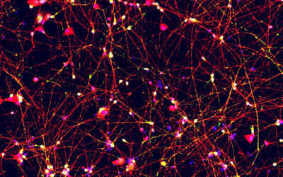 Parkinson’s Disease