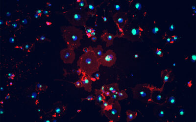 Smarca2 in Cancer